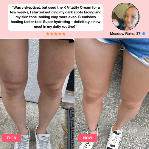 LuxeLift™ Cellulite Relief Kit