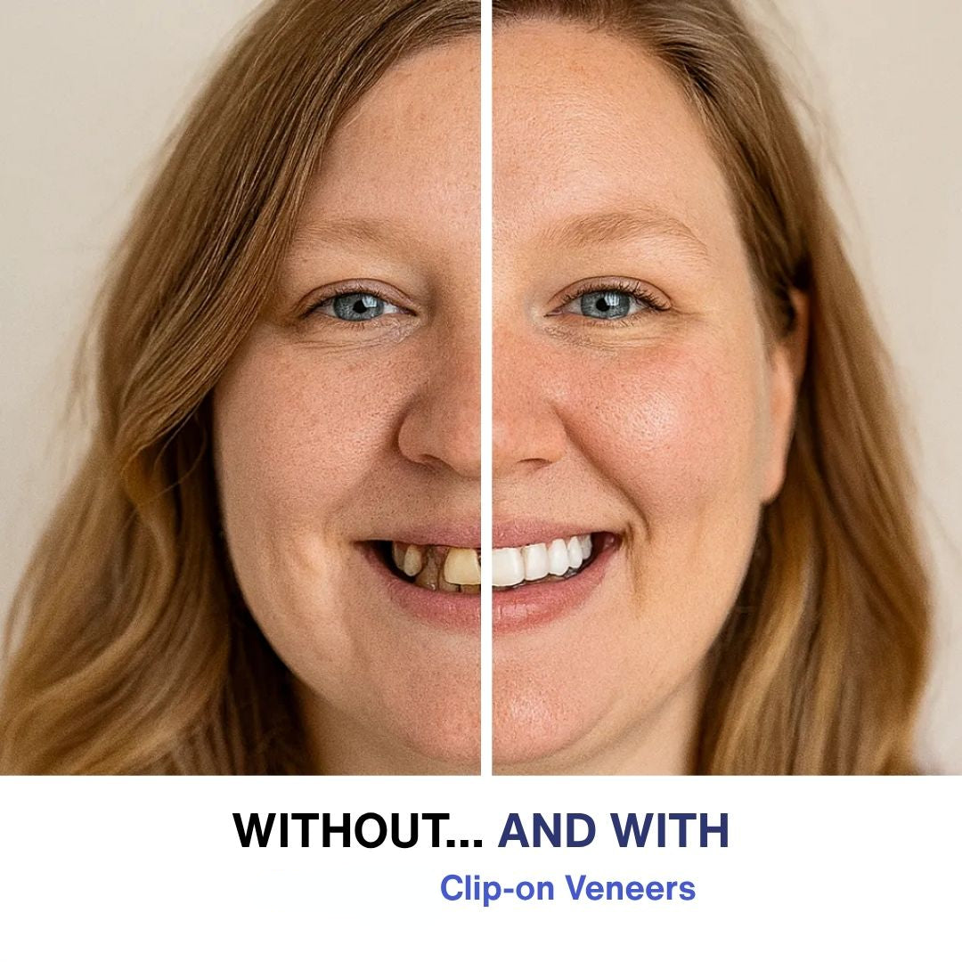 GlowSmile™ | Instant Snap-On Veneers